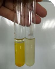 金葡菌種血漿凝固酶試驗不凝固？常見原因與解決對策全解析